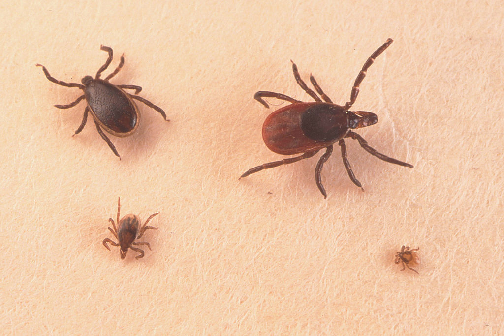 Ticks On Humans Can Transmit Lyme Disease