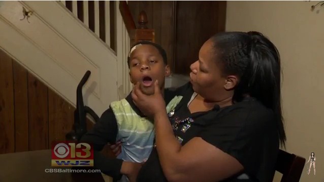 Mom Furious After School Pulled Son's Teeth Out With No Permission
