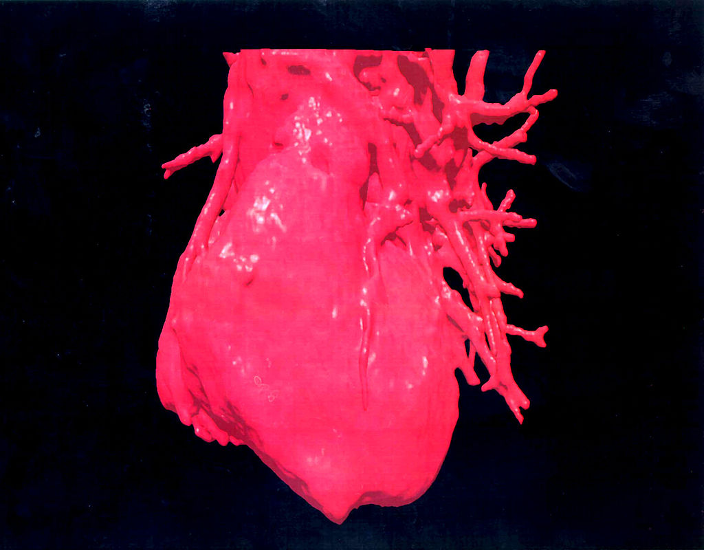 Giving The Heart A Second Chance? Anti-Cancer Drug Found To Help Regenerate Heart Tissues