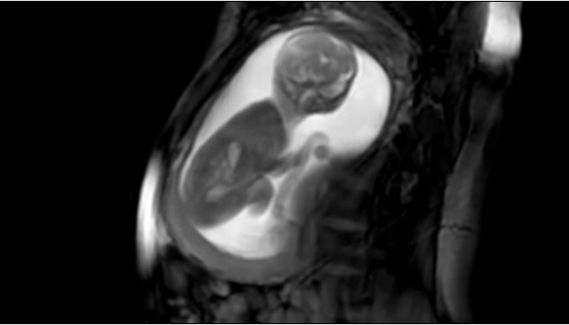 Amazing New Technology - MRI Scan Of Unborn Babies In The Womb Shows Baby Kicking, Smiling, and Wiggling