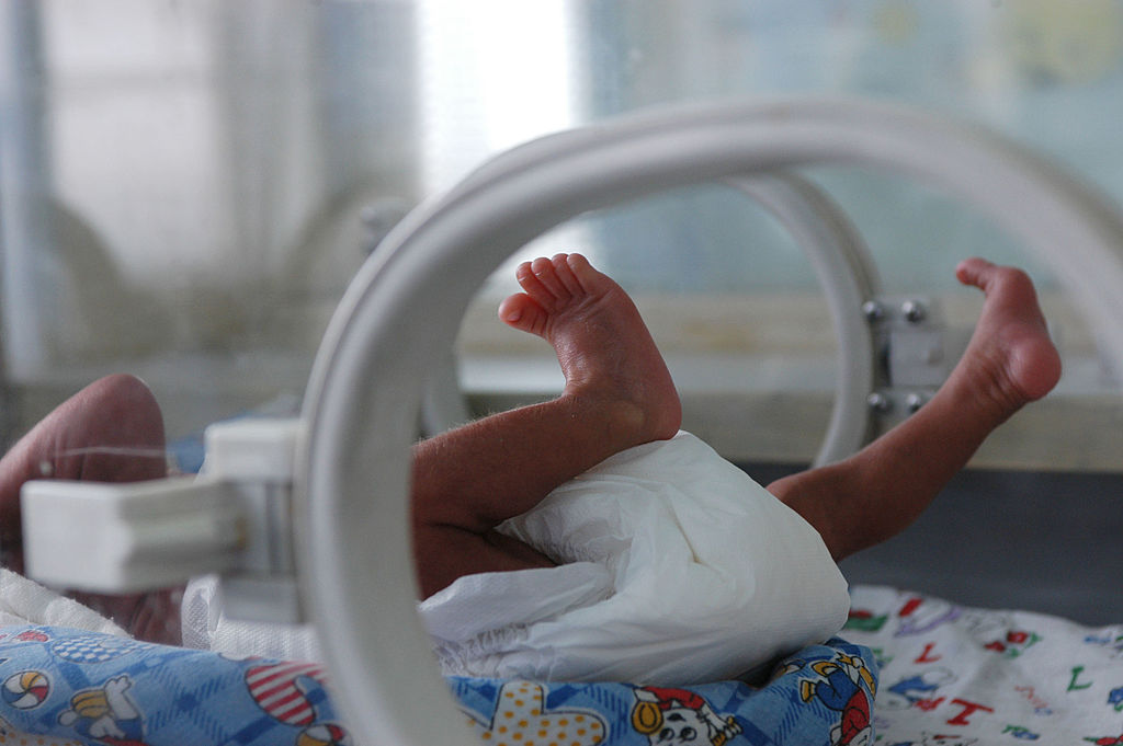 Tiny Premature Babies May Have Hgher Risk Of Mental Health Issues
