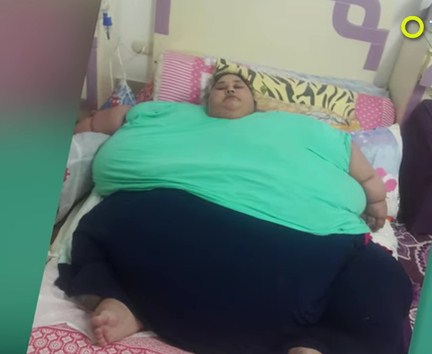 How World's Fattest Woman Lost Weight Before Her Life Saving Operation