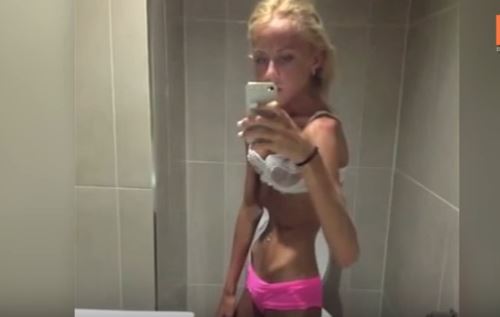 Teen Overcomes Anorexia After Near Death Experience