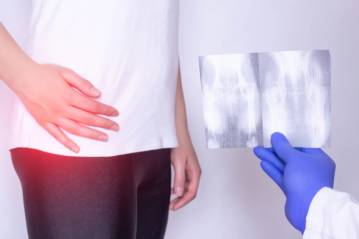 Doctor holds x-ray picture on the background of a girl with a sore hip joint and intervertebral hernia, fibromyalgia, close-up
