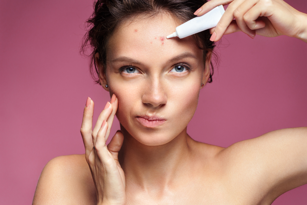 5 Tricks for Getting Rid of Your Acne at Home