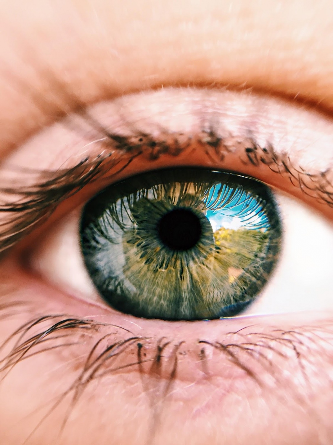 8 Things You Need To Consider Before Getting Lasik 