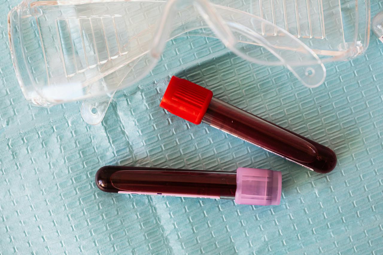 Accuracy of Blood Testing for Alzheimer's Disease Still Varies