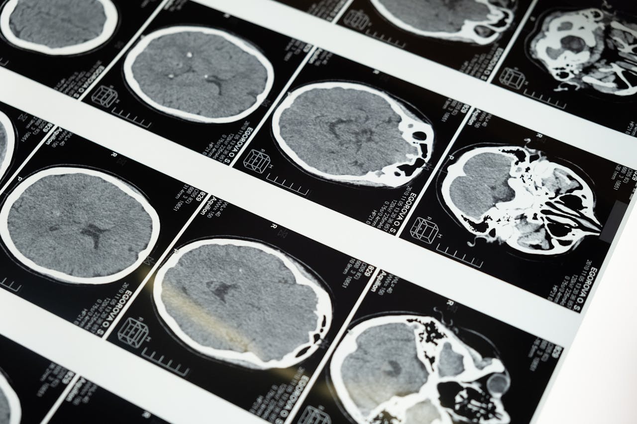 Study Reveals Brain Scans Aren't Always Accurate