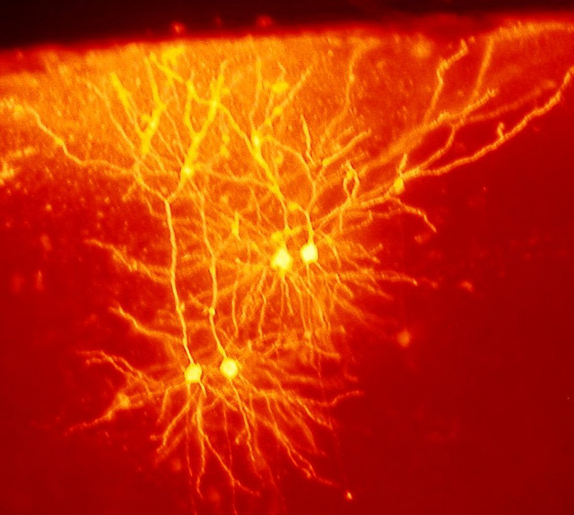 Brain,Neurons